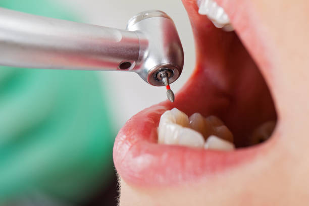 Best Emergency Treatment for Oral Infections in Palm Beach, FL